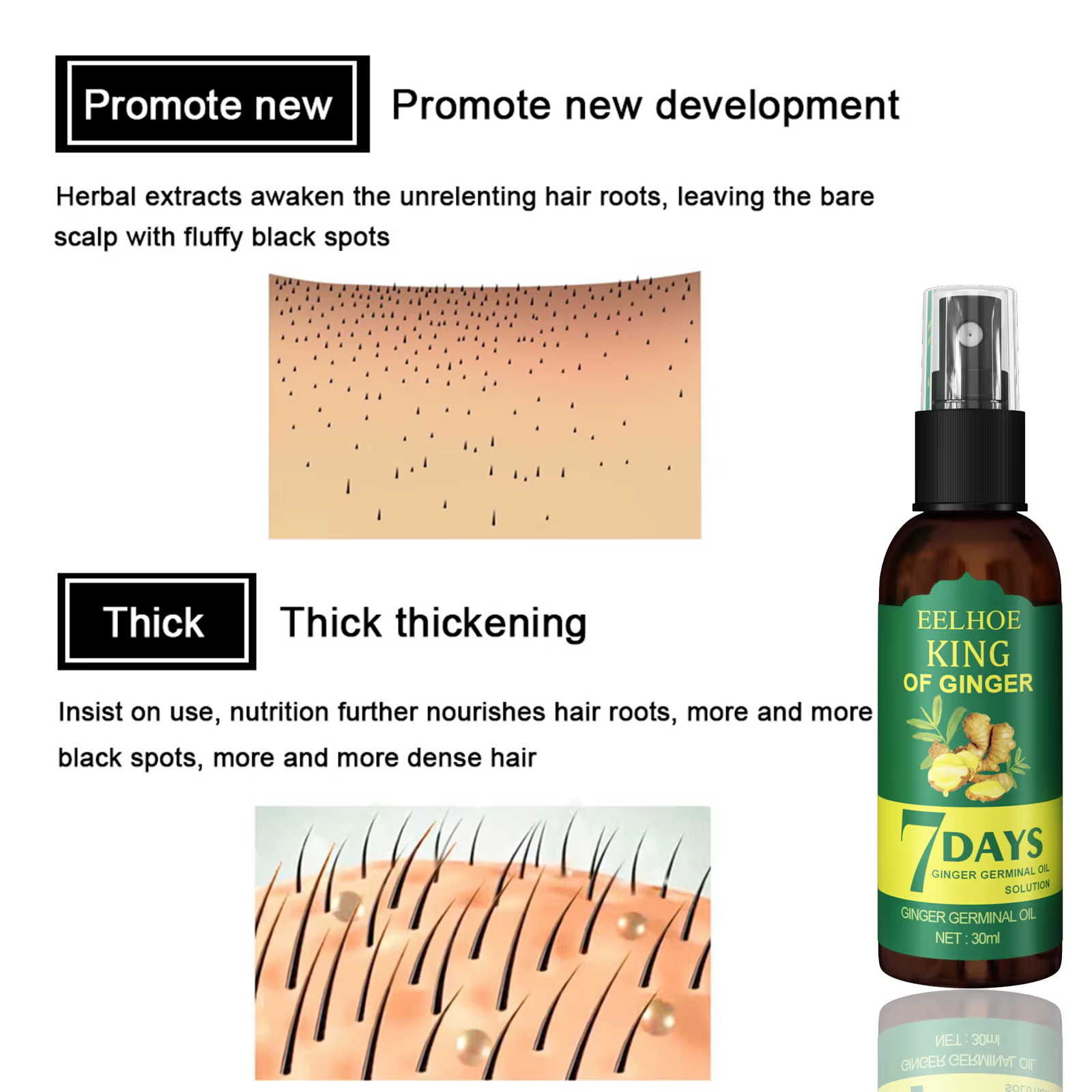 Sérum Booster capillaire à l'huile de gingembre, Spray nourrissant le cuir chevelu, contrôle des follicules pileux, huile rafraîchissante, renforce les racines des cheveux, Solution nutritive